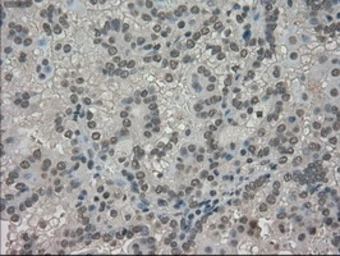 Anti-TRIB2 antibody [8D11] used in IHC (Paraffin sections) (IHC-P). GTX83495