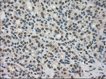 Anti-TRIB2 antibody [8D11] used in IHC (Paraffin sections) (IHC-P). GTX83495