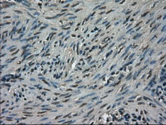 Anti-TRIB2 antibody [8D11] used in IHC (Paraffin sections) (IHC-P). GTX83495