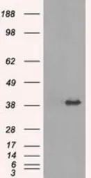 Anti-TRIB2 antibody [8D11] used in Western Blot (WB). GTX83495