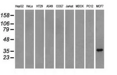 Anti-TRIB2 antibody [8D11] used in Western Blot (WB). GTX83495