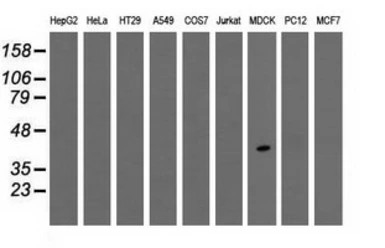 Anti-TPMT antibody [4C1] used in Western Blot (WB). GTX83497