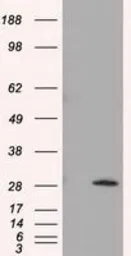 Anti-TPMT antibody [2A2] used in Western Blot (WB). GTX83498
