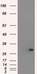 Anti-Cardiac Troponin I antibody [4A3] used in Western Blot (WB). GTX83501