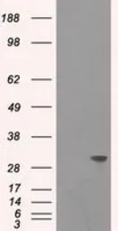 Anti-Cardiac Troponin I antibody [3G2] used in Western Blot (WB). GTX83502