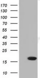 Anti-TMEM80 antibody [3B6] used in Western Blot (WB). GTX83505