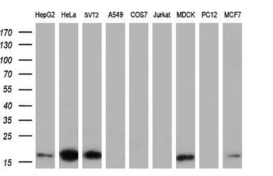 Anti-TMEM80 antibody [2B7] used in Western Blot (WB). GTX83506