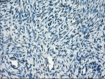Anti-TMEM100 antibody [10G3] used in IHC (Paraffin sections) (IHC-P). GTX83508