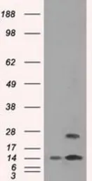 Anti-TMEM100 antibody [10G3] used in Western Blot (WB). GTX83508