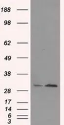 Anti-TIPRL antibody [3D11] used in Western Blot (WB). GTX83511