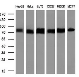 Anti-Transferrin antibody [5G2] used in Western Blot (WB). GTX83513