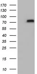 Anti-Transferrin antibody [5G2] used in Western Blot (WB). GTX83513