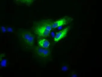 Anti-Transferrin antibody [5G2] used in Immunocytochemistry/ Immunofluorescence (ICC/IF). GTX83513