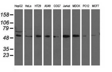 Anti-TCP11L2 antibody [2A10] used in Western Blot (WB). GTX83518