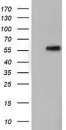 Anti-TCP11L2 antibody [2A10] used in Western Blot (WB). GTX83518