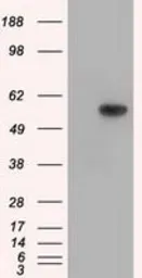 Anti-TXA synthase antibody [2C1] used in Western Blot (WB). GTX83523