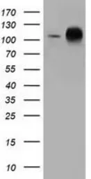 Anti-TACC3 antibody [1E11] used in Western Blot (WB). GTX83529