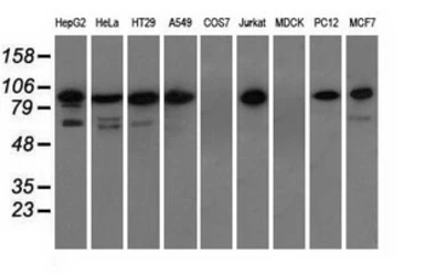 Anti-TACC3 antibody [1E11] used in Western Blot (WB). GTX83529