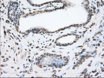 Anti-TACC3 antibody [6F1] used in IHC (Paraffin sections) (IHC-P). GTX83531