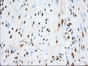Anti-TACC3 antibody [6F1] used in IHC (Paraffin sections) (IHC-P). GTX83531