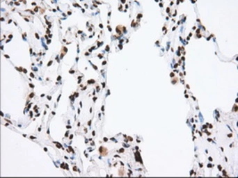 Anti-TACC3 antibody [6F1] used in IHC (Paraffin sections) (IHC-P). GTX83531
