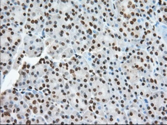 Anti-TACC3 antibody [6F1] used in IHC (Paraffin sections) (IHC-P). GTX83531