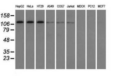 Anti-TACC3 antibody [6F1] used in Western Blot (WB). GTX83531