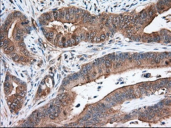 Anti-TACC3 antibody [7B11] used in IHC (Paraffin sections) (IHC-P). GTX83533