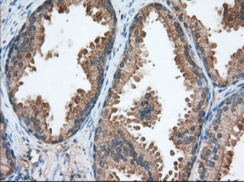 Anti-TACC3 antibody [7B11] used in IHC (Paraffin sections) (IHC-P). GTX83533