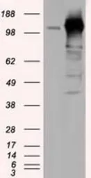 Anti-TACC3 antibody [7B11] used in Western Blot (WB). GTX83533