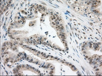 Anti-TACC3 antibody [8F6] used in IHC (Paraffin sections) (IHC-P). GTX83534