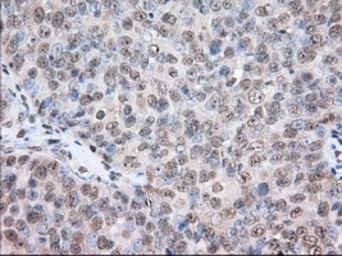 Anti-TACC3 antibody [8F6] used in IHC (Paraffin sections) (IHC-P). GTX83534