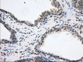 Anti-TACC3 antibody [8F6] used in IHC (Paraffin sections) (IHC-P). GTX83534