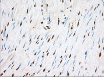 Anti-TACC3 antibody [8F6] used in IHC (Paraffin sections) (IHC-P). GTX83534