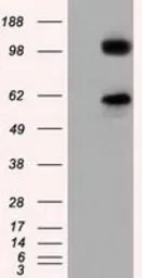 Anti-TACC3 antibody [8F6] used in Western Blot (WB). GTX83534