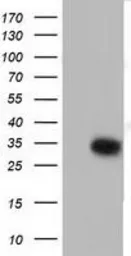 Anti-SULT2A1 antibody [3G4] used in Western Blot (WB). GTX83536