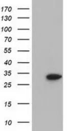 Anti-SULT2A1 antibody [4D7] used in Western Blot (WB). GTX83539