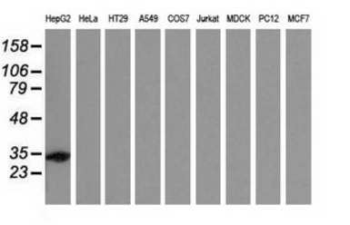 Anti-SULT2A1 antibody [4D7] used in Western Blot (WB). GTX83539