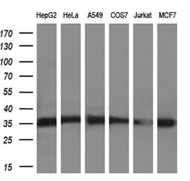 Anti-SULT2A1 antibody [7G10] used in Western Blot (WB). GTX83540