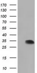 Anti-SULT2A1 antibody [7G10] used in Western Blot (WB). GTX83540