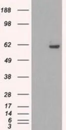 Anti-STK39 antibody [3C12] used in Western Blot (WB). GTX83541