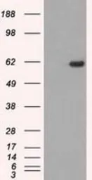 Anti-STK39 antibody [4E3] used in Western Blot (WB). GTX83542