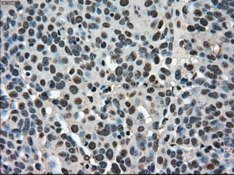 Anti-STK39 antibody [2E10] used in IHC (Paraffin sections) (IHC-P). GTX83543