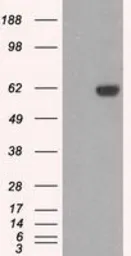 Anti-STK39 antibody [2E10] used in Western Blot (WB). GTX83543