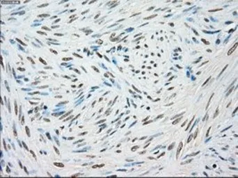 Anti-STK3 antibody [4G10] used in IHC (Paraffin sections) (IHC-P). GTX83546