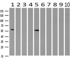 Anti-STK3 antibody [4G10] used in Western Blot (WB). GTX83546
