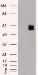 Anti-STK3 antibody [4G10] used in Western Blot (WB). GTX83546