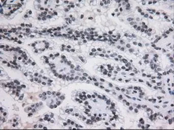 Anti-STAT3 antibody [21E7] used in IHC (Paraffin sections) (IHC-P). GTX83549