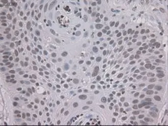 Anti-STAT3 antibody [21E7] used in IHC (Paraffin sections) (IHC-P). GTX83549