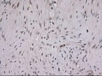 Anti-STAT3 antibody [21E7] used in IHC (Paraffin sections) (IHC-P). GTX83549